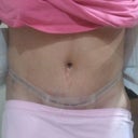 2DPO Front...before shower so sorry for the icky bb