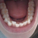 tray 8
