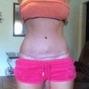 Almost 2 months PO Scar
