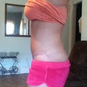 Almost 2 months PO Side