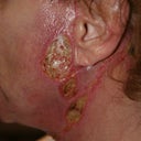 LIFE THREATENING LSL - 