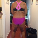 Lipo 6 days after thighs, flank and knees
