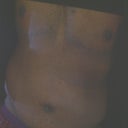 19 days since the surgery. The swelling has gone down and my stomach is much flatter than it was just four days ago.