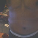 19 days since the surgery. The swelling has gone down and my stomach is much flatter than it was just four days ago.