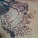 3 days post treatment...oh the damn itch! Still some small blisters and swelling. Bring on the fading!