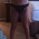 after, 48 hrs. post op