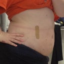 2 weeks post