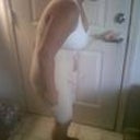Me trying to stand up on Saturday, four days after surgery.