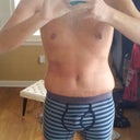 2 weeks post op