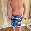 2 weeks post op