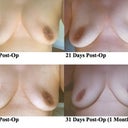 Day 17, Day 21, Day 28, Day 31.  I still see subtle changes from day to day.
