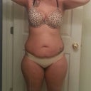 Before Pic 1