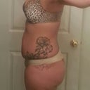 Side View