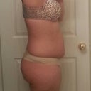 Another Side View