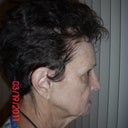 Here is a profile of my turkey neck