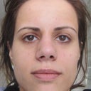 2-25-12: 2.5 months post-op - again sorry about the scary morning face but I figured it'd be more informative if the nose was seen without makeup disguising the imperfection