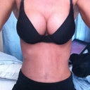 3 weeks post op... below the belly button is still very swollen so I always choose to hide it ;)