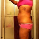 side view,  alot of swelling