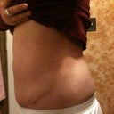 5 weeks post op.