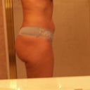 Side Day 14 (still swollen!!)