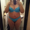 Day 11 still very swollen in my belly. But its starting to flatten out. My belly button is off due to swelling. That bothers me :(