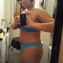 Day 11 side view. Tummy has gone down a bit. Doesn't protrude as much.