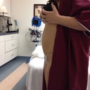 Day of Surgery.