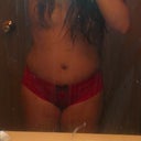 2 weeks today, still swollen but less than before