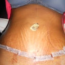 p.o day 4 laying dwn,,,,