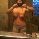 12 days post op mommy makeover