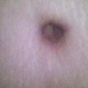 Belly button looks pretty good.