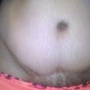 Front view - 4.5 mos PO
