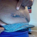 WTH is this? Suture rejection? Pus pocket/blister?