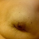 8 weeks - I hope chronically this with photos helps someone.