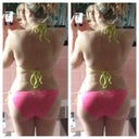 Pic at 2 weeks post op. left side is me. Right is with the lipo app the lower butt cheek is rounded out a bit more, which is what would make the results virtually perfect. I know I'm being critical :(