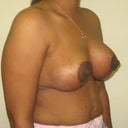 wich pic dr p pt