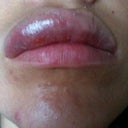 4 days after