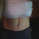 1 month post op