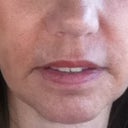 Just one week after