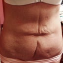 April 20, 2012.  Just before I left for Surgery.