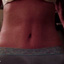 May 28, 2012,  5 weeks post op tummy tuck.  Still a little swollen late in day, but feeling much better about the look.