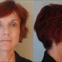 These are pictures from the day before the surgery. No make-up and crazy hair.