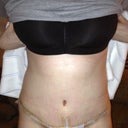 8dpo scar