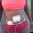 after front view no more love handles or muffin top pod 2