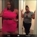 Me 7 weeks after VSG surgery... can you see the difference?