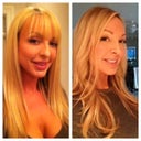 Before and after 6 weeks post op, toned my hair and changed my part to add to the makeover :)