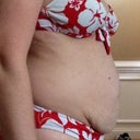 Before Mommy Makeover Pic 2