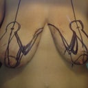 before surgery