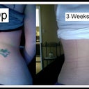 3 Weeks Post Op Tummy tuck Before and After Rear