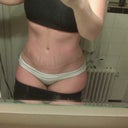 4 Weeks 1 Day Post Op tummy tuck - At Night No Swelling